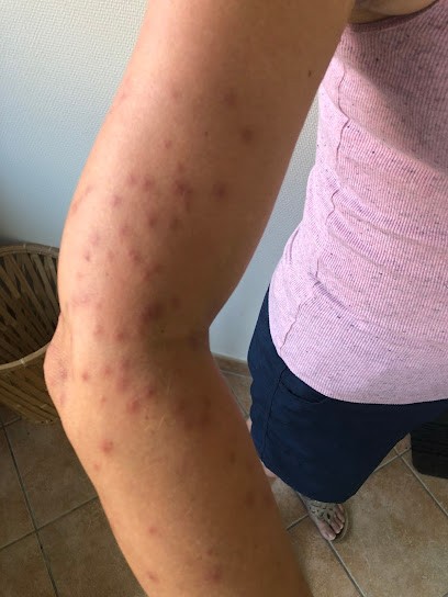 Alto Punaises, Désinsectiseur et Dératiseur à Yenne